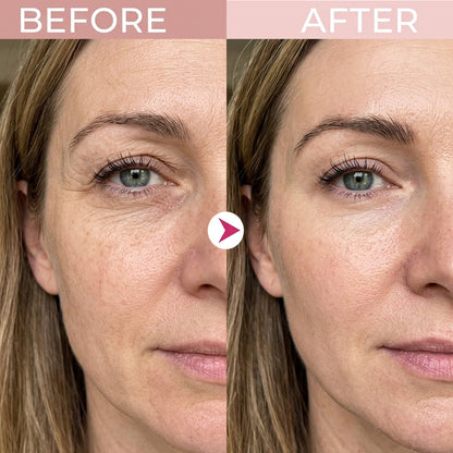 🔥Final 2 Hour 76% OFF🔥 P7 Eye Renewal Crème